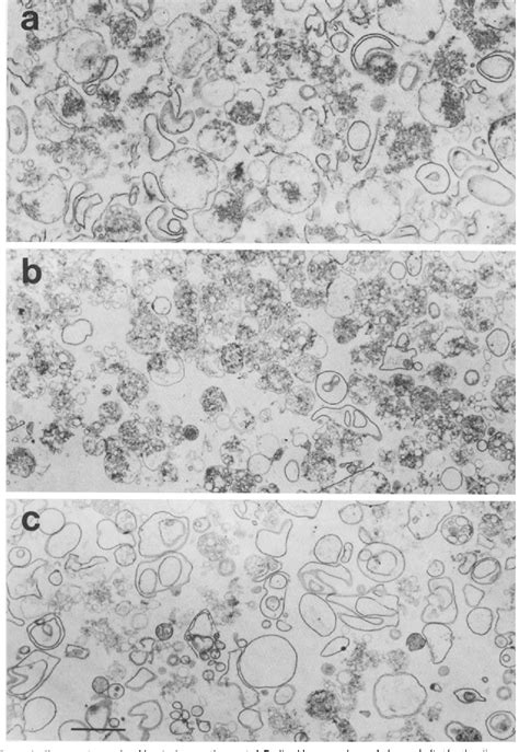 Figure From A Membrane Cytoskeleton From Dictyostelium Discoideum I