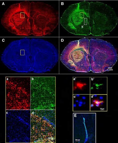 Pbr Tspo Green And Cd B Red Microglial Expression In The Ampa