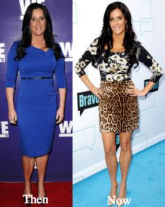 Patti Stanger Plastic Surgery Before and After Photos