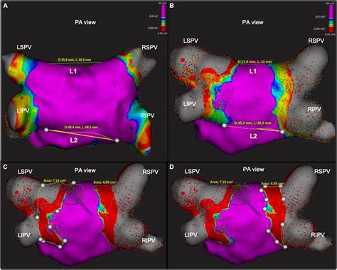 Frontiers | Ultra-high-resolution assessment of lesion extension after