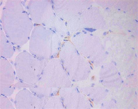 A Immunohisto Chemical Staining Of A Skeletal Muscle With Cap