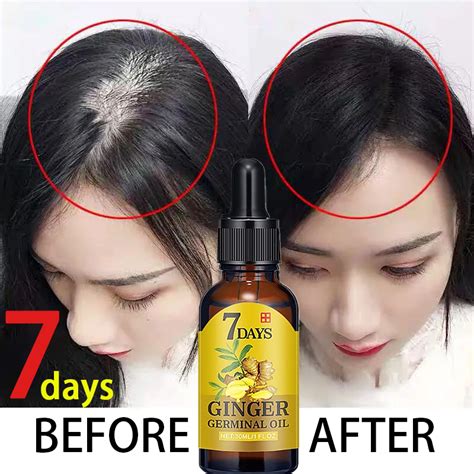 7 Days Ginger Germinal Oil Ginger Hair Growth Essence Hair Loss Liquid