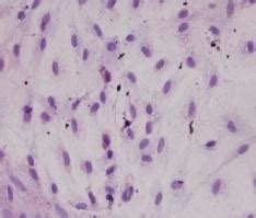 Description Of Mature Adipocytes On Day 6 With Oil Red O Staining