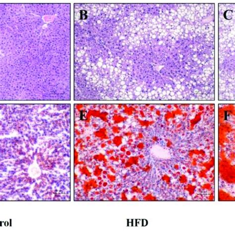 Histopathology Analysis Of Liver Tissues From The Mice In Different Download Scientific Diagram