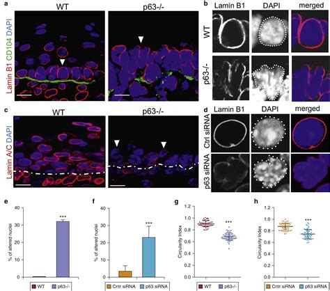 P63 Transcription Factor Regulates Nuclear Shape And Expression Of