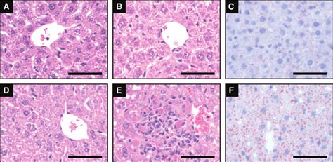 Liver Histopathology In Rats And Mice Following Tcdd Exposure Rats Download Scientific Diagram