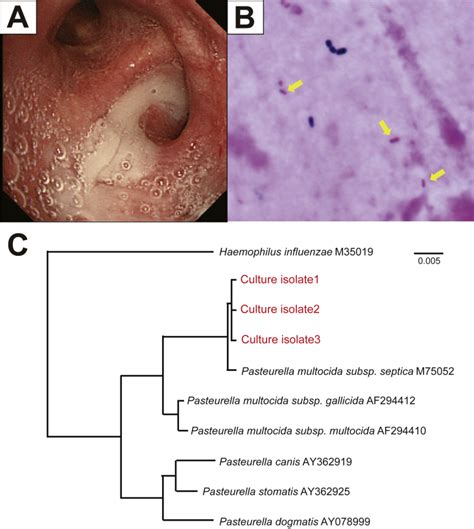 Pasteurella Multocida Human Infection