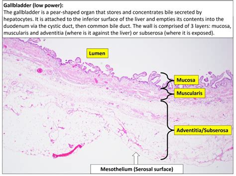 Gallbladder Normal Histology Nus Pathweb Nus Pathweb