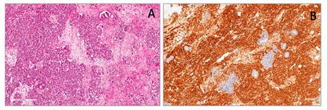 Applied Sciences Free Full Text Immunohistochemical Expression Of