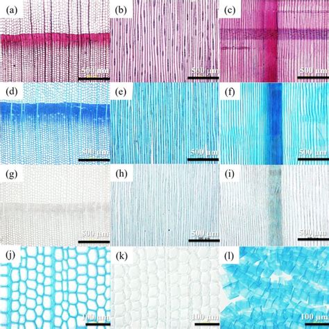 Optical Micrographs Of The Standard Sections Of The Various Samples