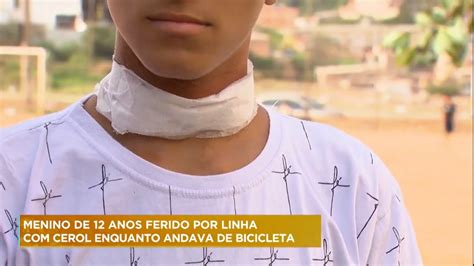 Menino de 12 anos é ferido por linha cerol enquanto andava de