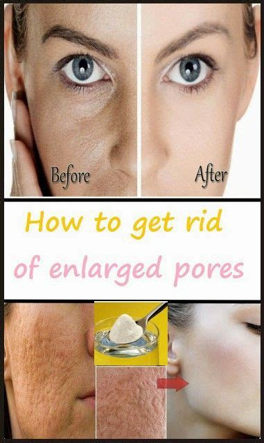 How To Get Rid Of Enlarged Pores Enlarged Pores Moisturizer For Oily