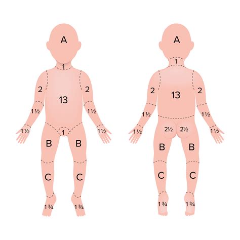 REGRA DOS 9 QUEIMADURAS Aprenda a calcular a SUPERFÍCIE CORPORAL