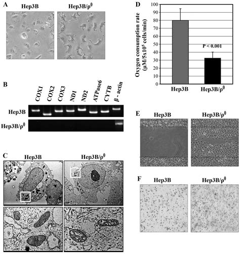 Mitochondrial Dysfunction Induces Emt Through The Tgf Smad Snail