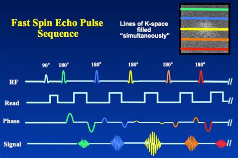 Tse Fse Questions And Answers In Mri