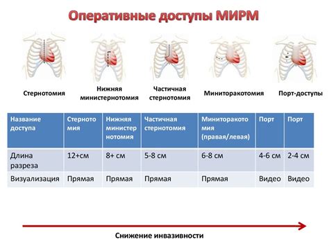 Миниинвазивная реваскуляризация миокарда - презентация онлайн