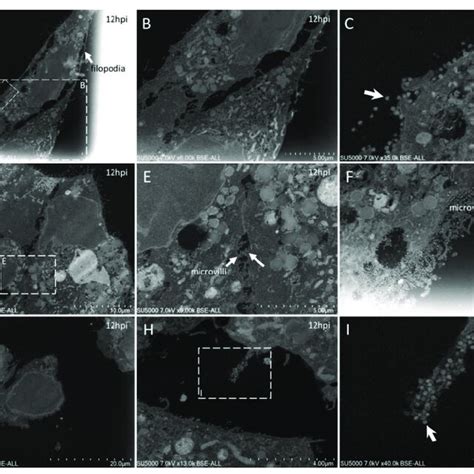 Ultra Thin Sections Of SARS CoV 2 Infected Vero E6 Cells 18 Hpi