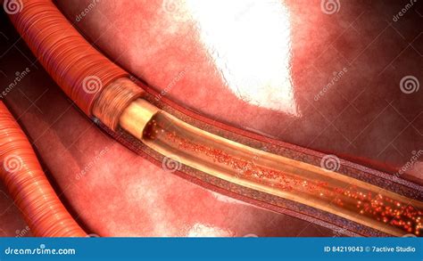 Human Artery Stock Image Image Of Microbiology Medicine 84219043