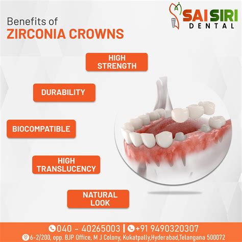 The Beauty of Zirconia Crowns