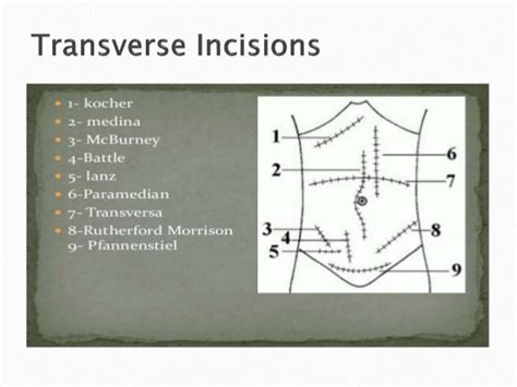 Surgical Incisions