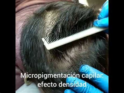 Microcapilar efecto densidad Resultados rápidos YouTube