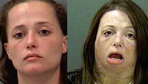 Top 10 Shocking Before And After Drug Use Photos | HubPages