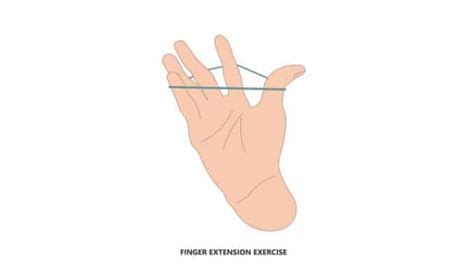 Finger Extension Exercise - Exercises For Injuries