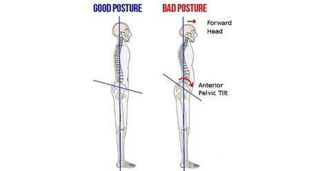 How To Correct An Anterior Pelvic Tilt With These Stretches