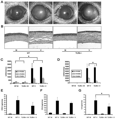 Adenovirus Keratitis