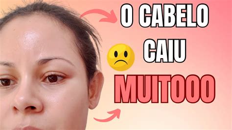 Por Isso QUE Seu CABELO CAI Tanto YouTube