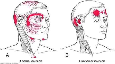 Neuromuscular Therapy For Temporomandibular Joint Disorders And