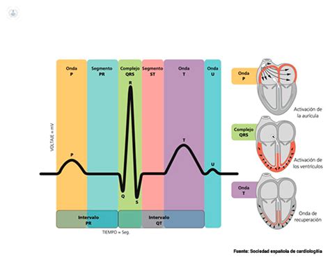 Estenosis aórtica causas y tratamiento Top Doctors