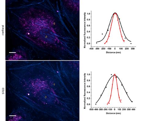 Confocal And STED Microscopy Images Of IgG 8 Labeled Mitochondrial