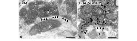 Electron Micrographs Showing Axon Terminals Singly Labeled With BDA A