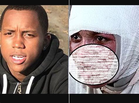 Hot Water Challenge Leaves Year Old Severely Burned Video