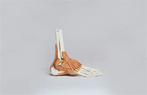 Peroneal tendonitis - Lucas Massage Therapy