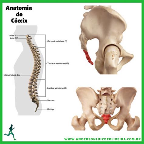 Dor No Cóccix Coccigodínea Dr Anderson Luiz De Oliveira