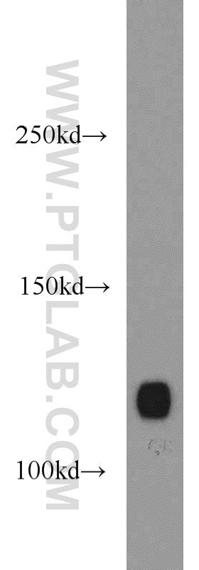 Integrin Alpha 3 Fusion Protein Ag17293 Proteintech