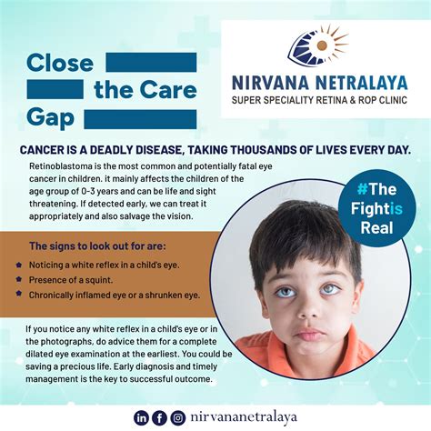 Don't let their sparkle fade! Learn... - Nirvana Netralaya