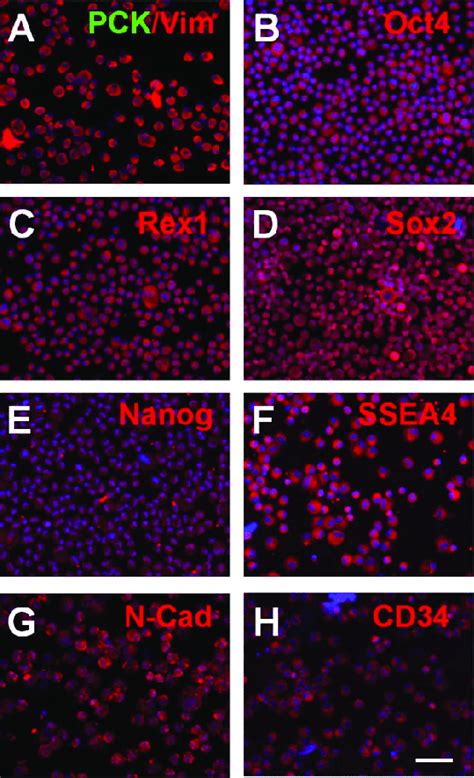 Phenotypic Characterization Of P Expanded Limbal Mesenchymal Cells