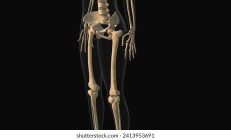 Medical Animation Femur Bone Pain 3d Stock Illustration 2413953691 | Shutterstock