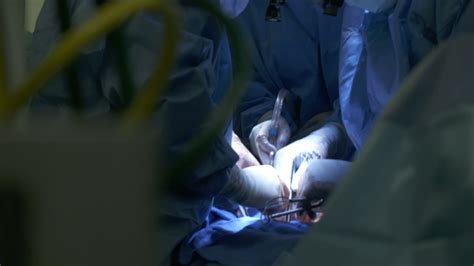 Organ transplant facts: US records 1 millionth milestone - ABC7 Los Angeles