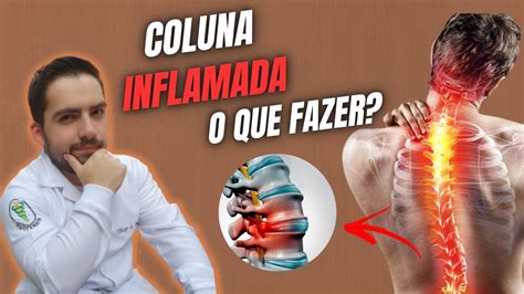 Sinais De Uma Coluna Inflamada Entenda Como Identificar Youtube