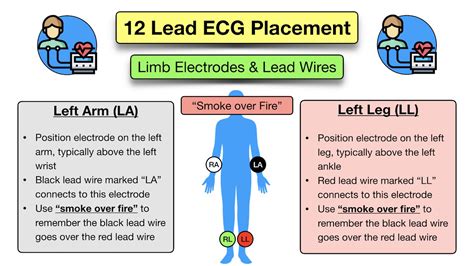 12 Lead Ecg Placement Diagram And Mnemonic For Limb And Precordial