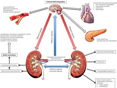 Renal Sympathetic Denervation Therapy For Resistant Hypertension