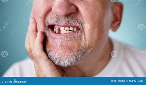 Sore Tooth And Decay Man Dental Health Stock Photo Image Of Senior