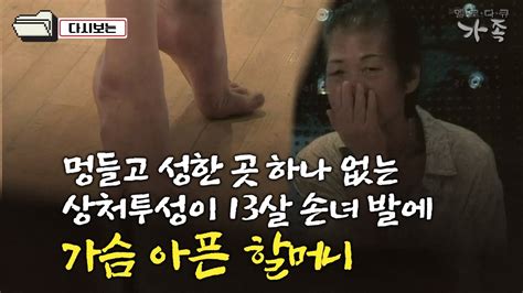 다큐 가족 92회④ 멍들고 성한 곳 하나 없는 상처투성이 13살 손녀 발에 가슴 아픈 할머니 Youtube