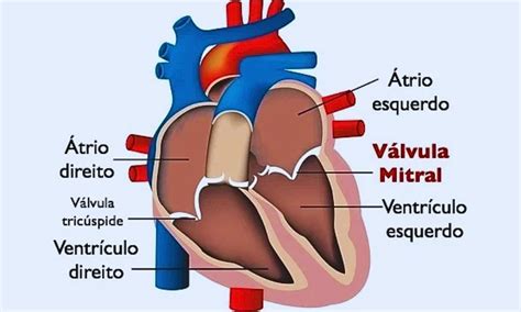 Valvulopatía Mitral Anatomía Tipos Y Tratamientos