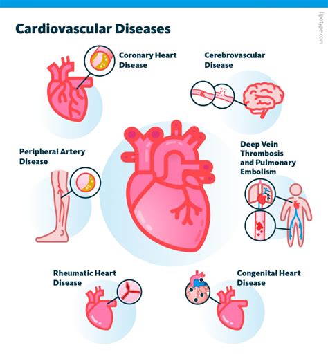 Iot Cardiovascular Disease Detection And Prevention Project Smartech