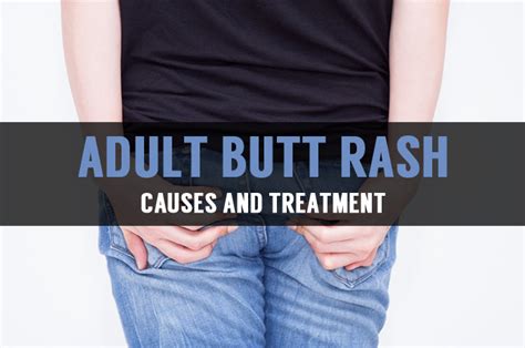 Learn About Adult Butt Rash And Its Treatment